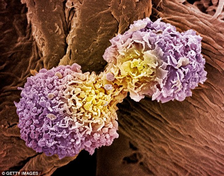 أنجلينا جولي خضعت لجراحة عام 2013