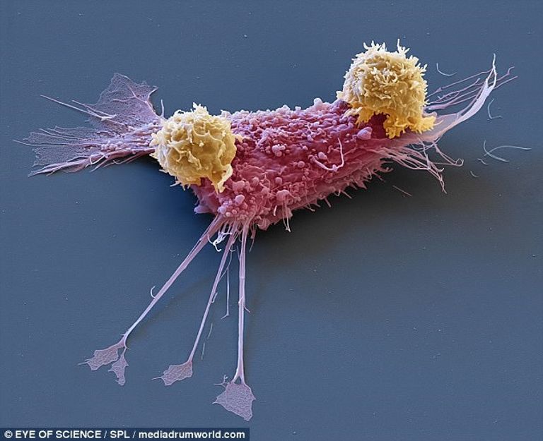 خلايا سرطانية أثناء مقاومتها للعلاج