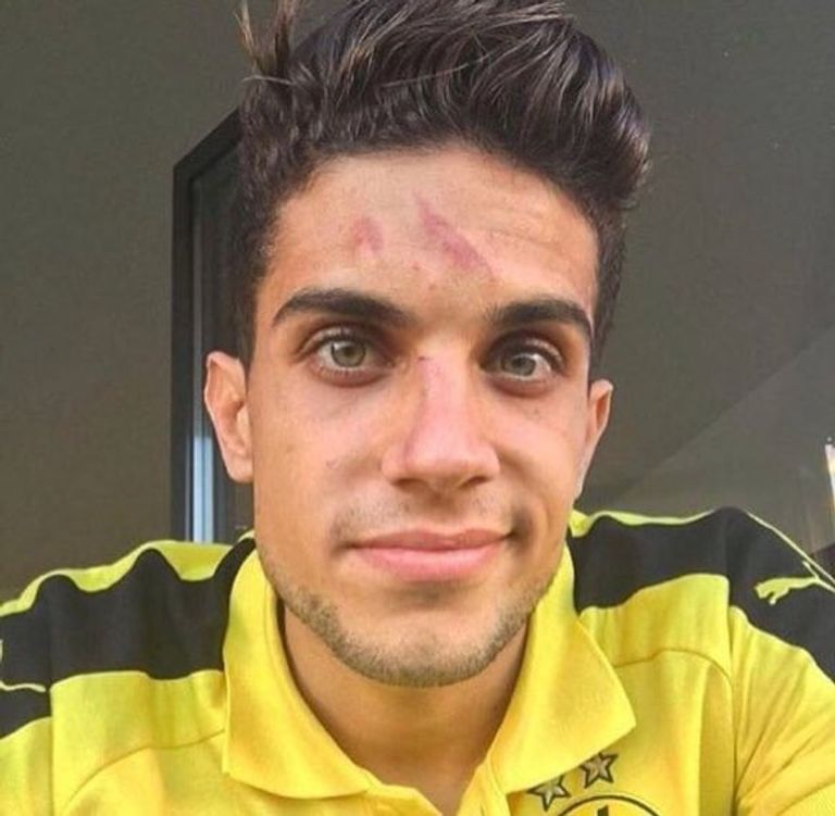 مارك بارترا