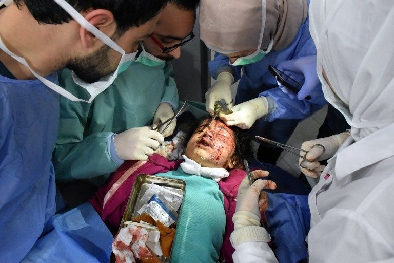 أحد الأطفال المصابين في التفجير الانتحاري (الفرنسية)