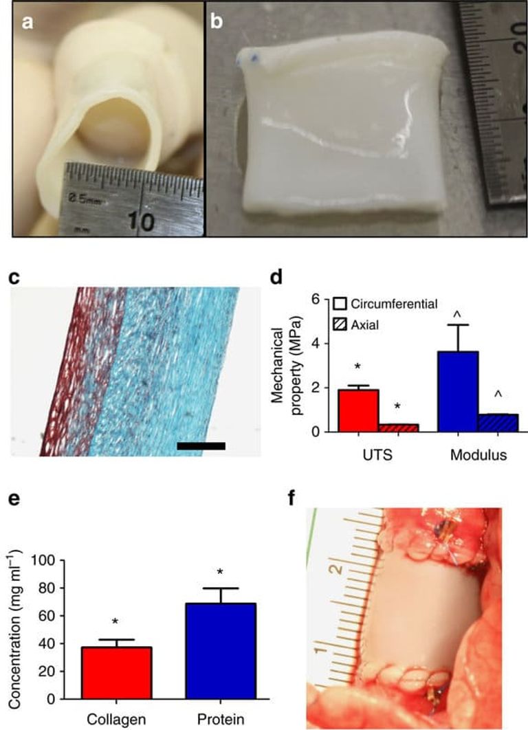 أوعية دموية صناعية 