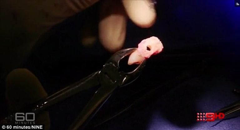 الكفيف فقد بصره على مدى 16 عاما