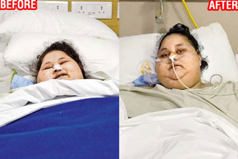 أسمن امرأة في العالم