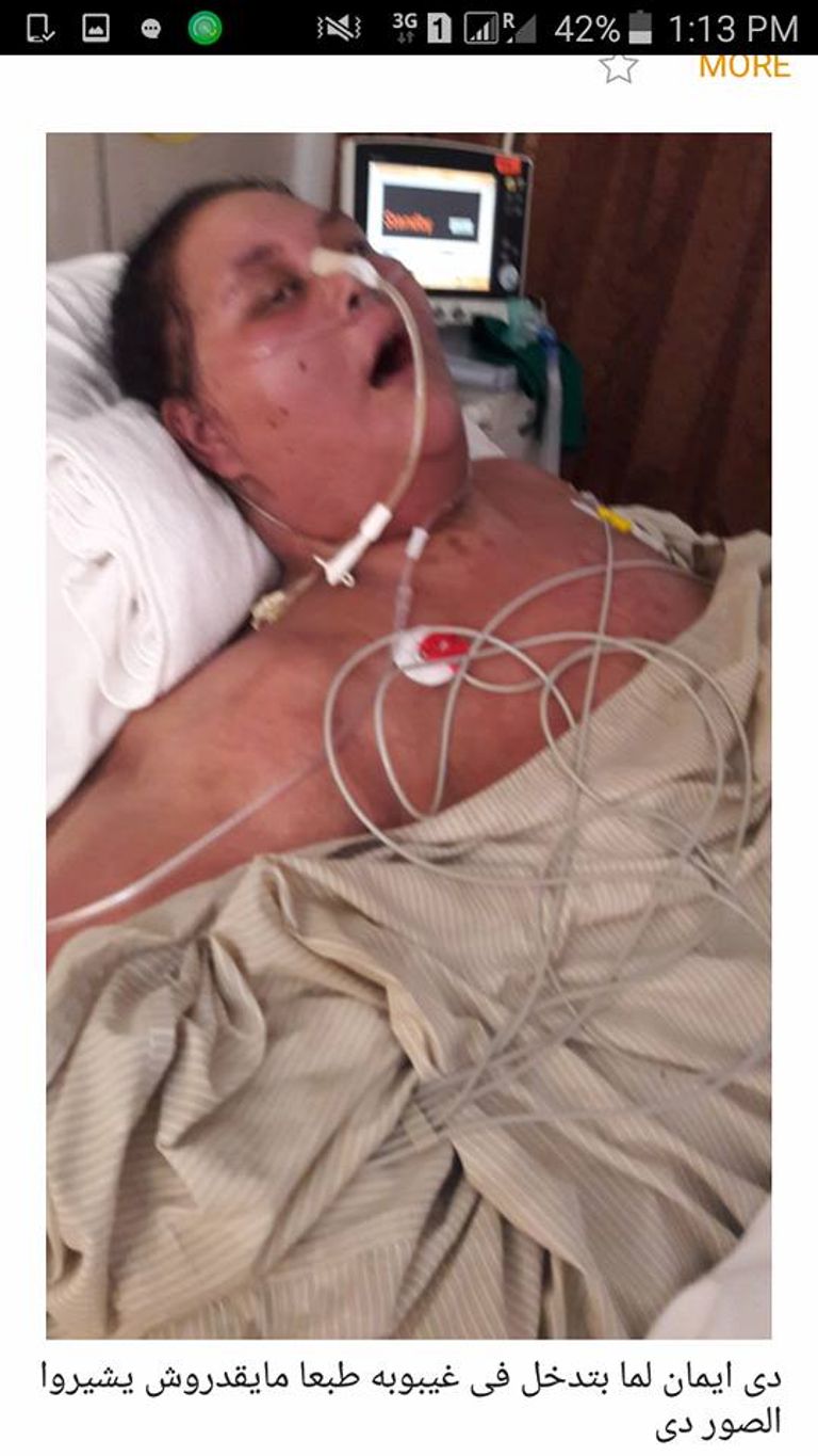 صورة أرشيفية لإيمان التي تعد أسمن امرأة في العالم