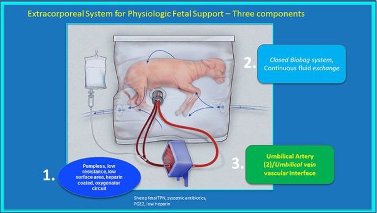 الرحم الصناعي ينقذ آلاف الأطفال