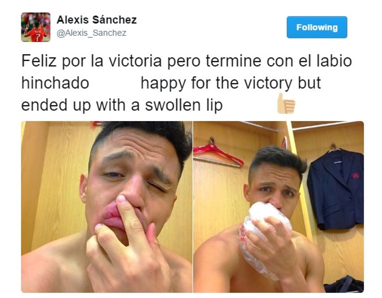 سانشيز وهوث