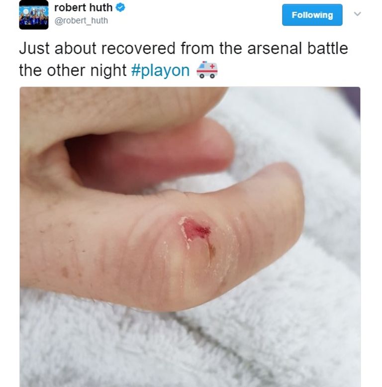 سانشيز وهوث