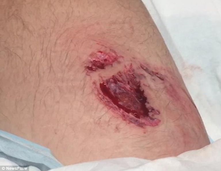 سمكة القرش بعد صيدها