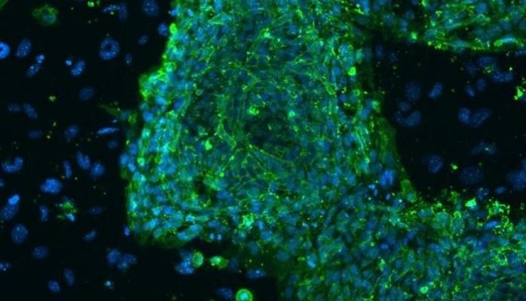 صورة مجهرية توضح خلايا جذعية من الحبل السري- أرشيفية