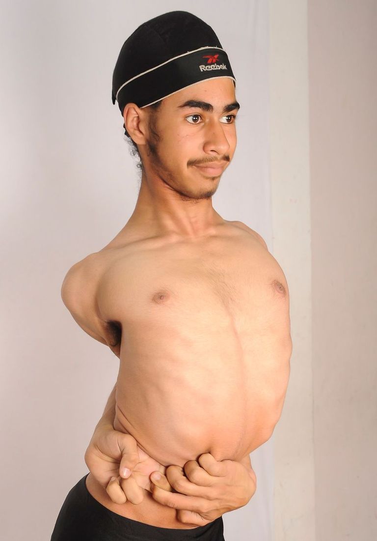 الفتى الهندي المطاطي