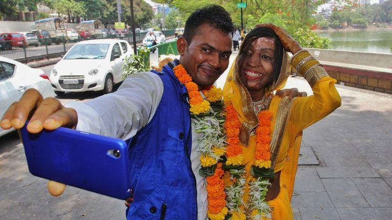 العروس ضحية الهجوم الحمضي