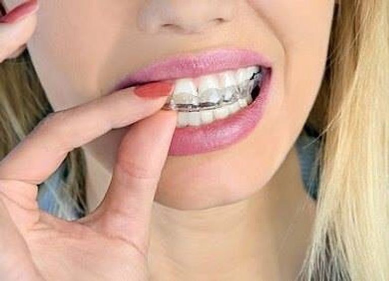 70% من المصابين بصرير الأسنان يعانون من التوتر