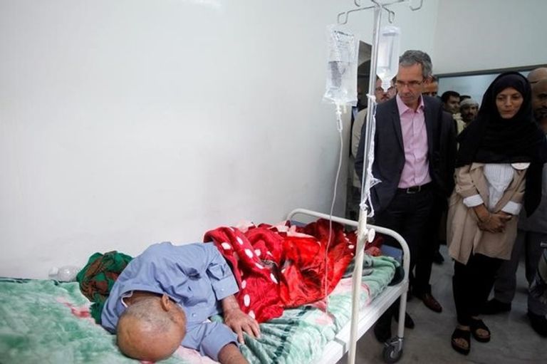 الأوبئة تضرب اليمن