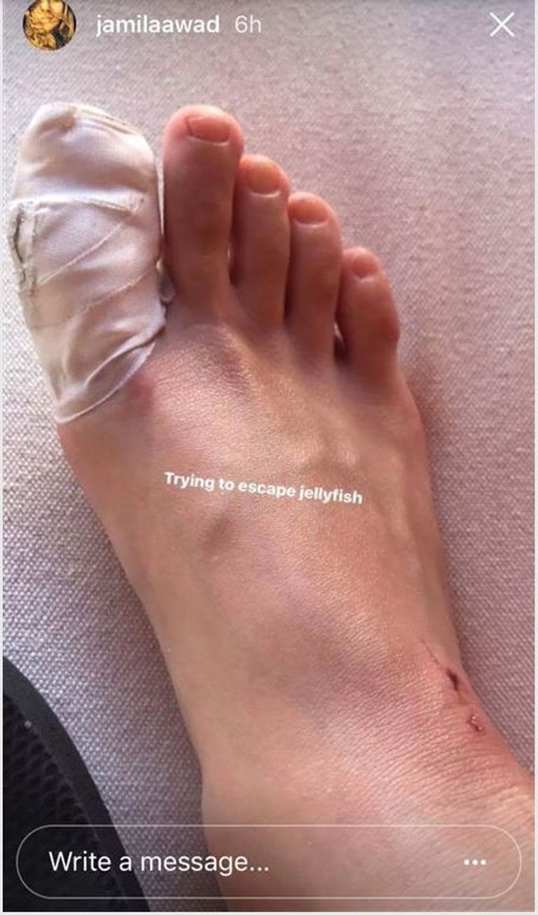 قناديل البحر انتشرت بالشواطئ المصرية