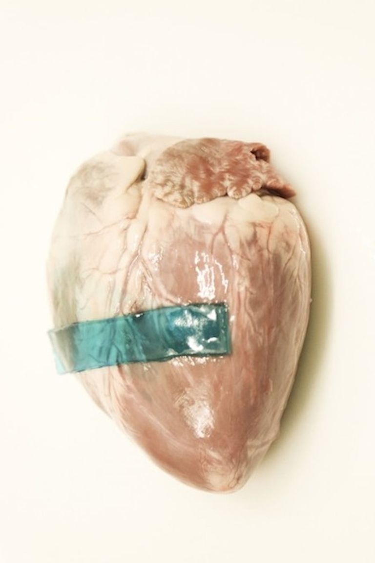 مادة لاصقة للجروج مستوحاة من الحلزون