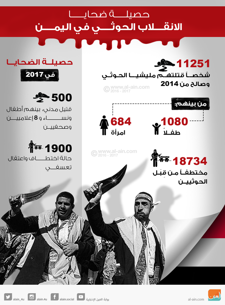 الأطفال أكثر عرضة للإصابة بالكوليرا