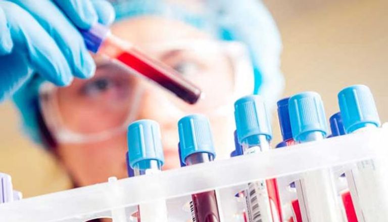 تحليل جديد للدم يكشف عن السرطان في مراحله المبكرة