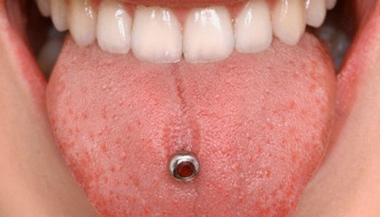 أمراض يمكن التعرف عليها من لون اللسان