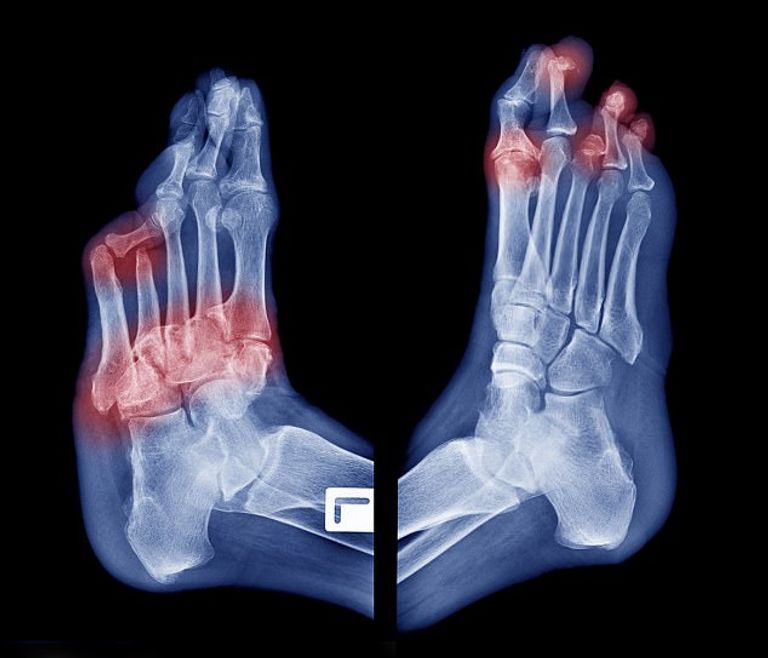 بساط لإنقاذ مرضى السكري