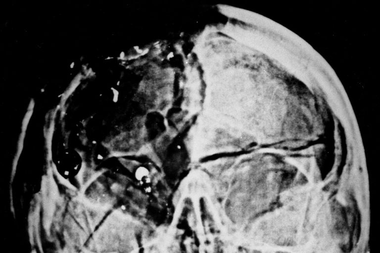 إطار خال لإحدى اللوحات المسروقة من متحف جاردنر بمدينة بوسطن الأمريكية