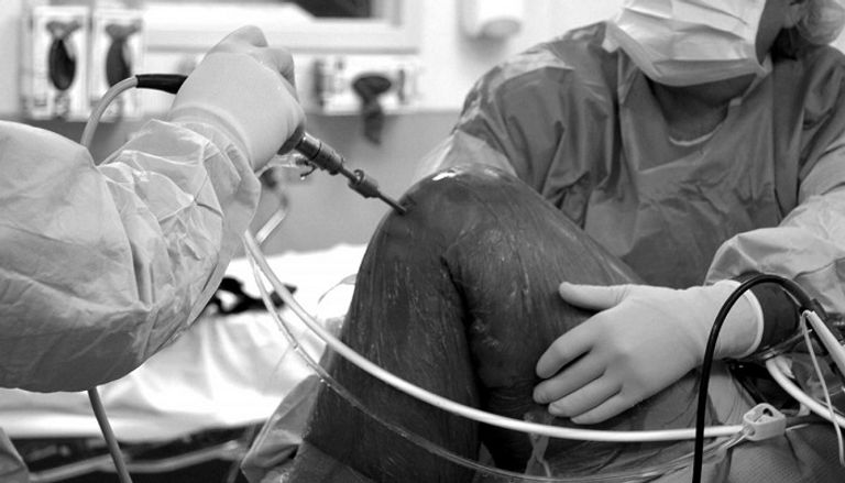 بيج كاس قبل إجراء الجراحة