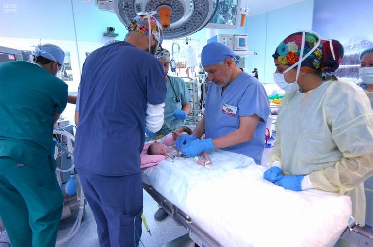 عملية فصل التوأم السيامي في الرياض