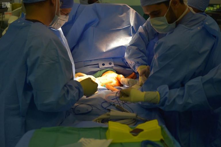 عملية فصل التوأم السيامي في الرياض