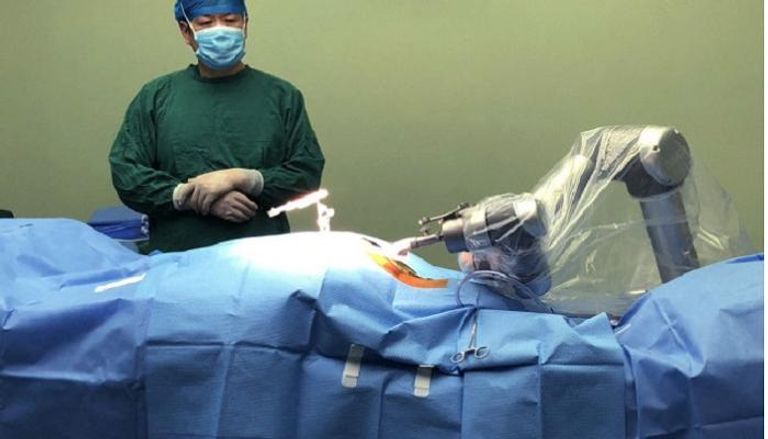 الروبوت الوحيد في العالم لجراحات العظام المُطور في الصين