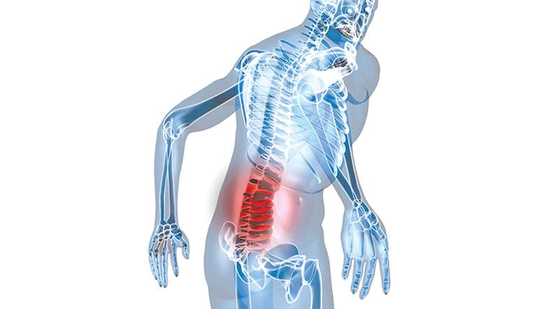 منطقة الظهر واحدة من أهم 4 مناطق يعاني من آلامها الأشخاص البالغون