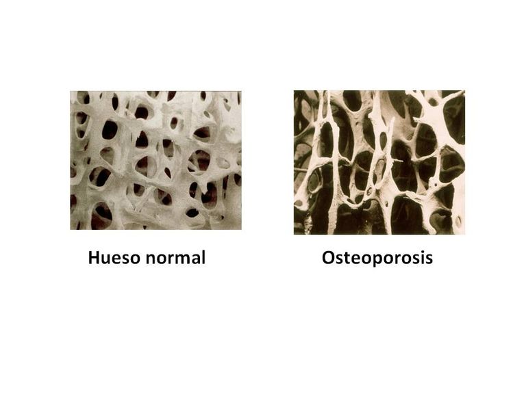 منتجات الألبان تحافظ على عظام الأطفال - أرشيفية