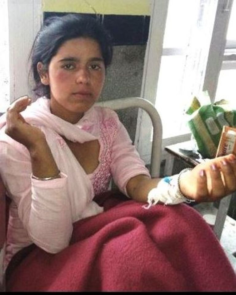 مانيشا فيرما تتلقى العلاج بعد إحدى اللدغات