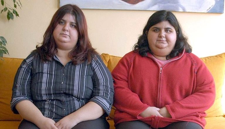  زيادة معدلات السمنة لدى الأتراك