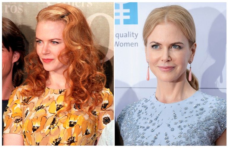 نيكول كيدمان قبل وبعد جراحة التجميل جنون جراحات التجميل يطارد نجوم هوليوود