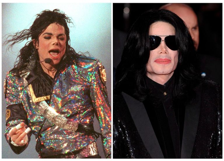 مايكل جاكسون قبل وبعد جراحة التجميل جنون جراحات التجميل يطارد نجوم هوليوود