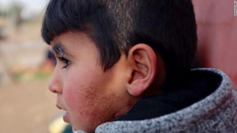 الطفل العراقي أيهم آزاد