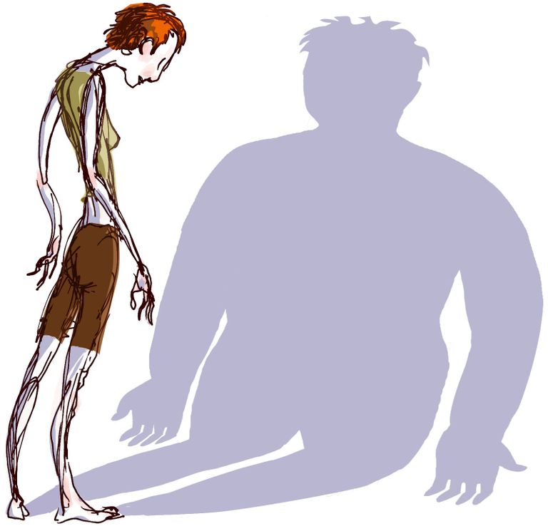 مرض فقدان الشهية العصابي.. هوس الرشاقة المميت - صورة أرشيفية