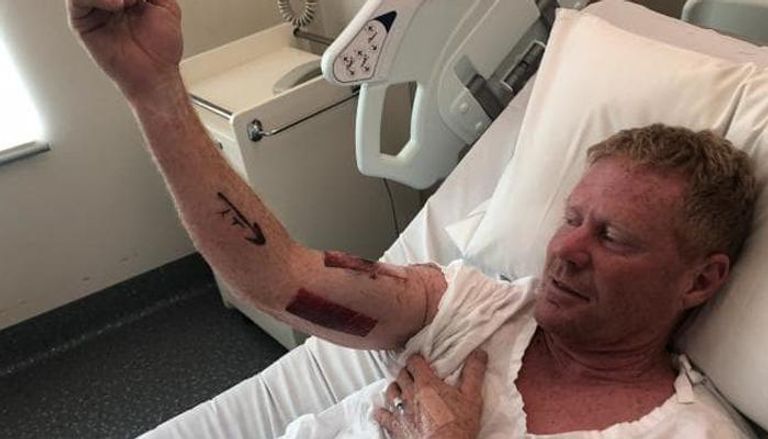 بول كيني راكب أمواج أسترالي في المستشفى يتلقى العلاج