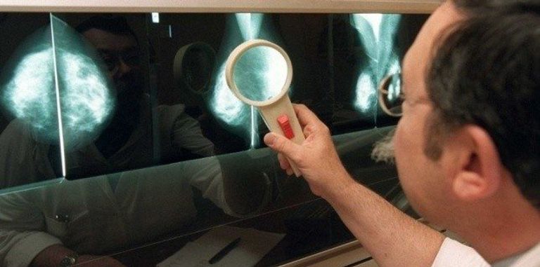 تشخيص المرض مقر المركز الوطني لمكافحة السرطان في الجزائر