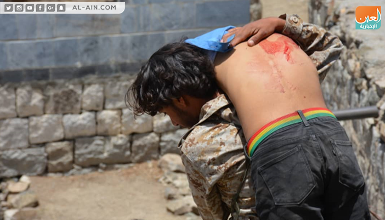 طفل مصاب برصاص قناصة مليشيا الحوثي
