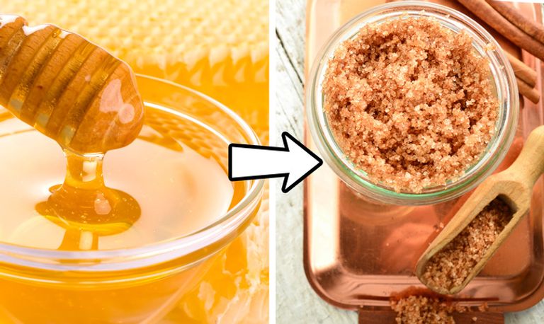 كيف تحصلين على أقدام ناعمة في الشتاء من مكونات بسيطة في المنزل؟