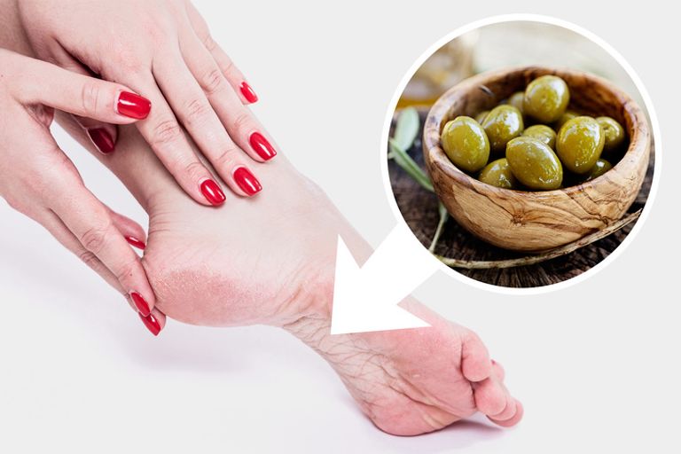 كيف تحصلين على أقدام ناعمة في الشتاء من مكونات بسيطة في المنزل؟