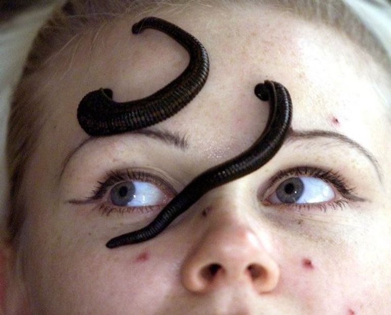 نزلات البرد - صورة أرشيفية