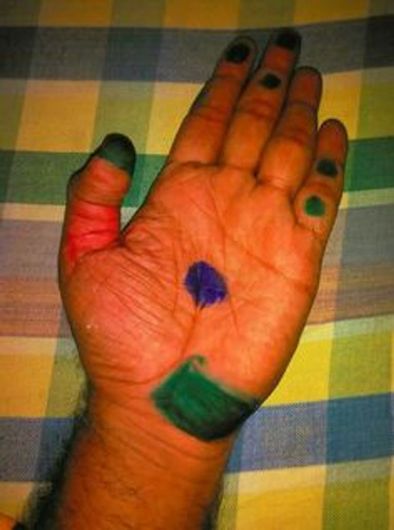 نزلات البرد - صورة أرشيفية