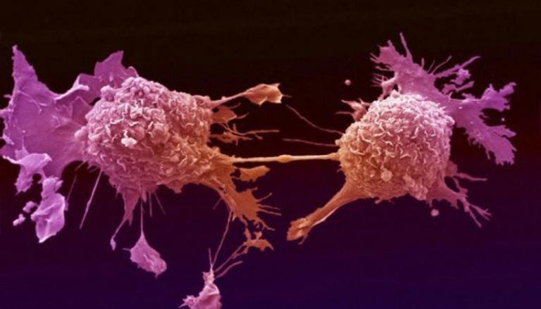 خلايا سرطانية - صورة أرشيفية