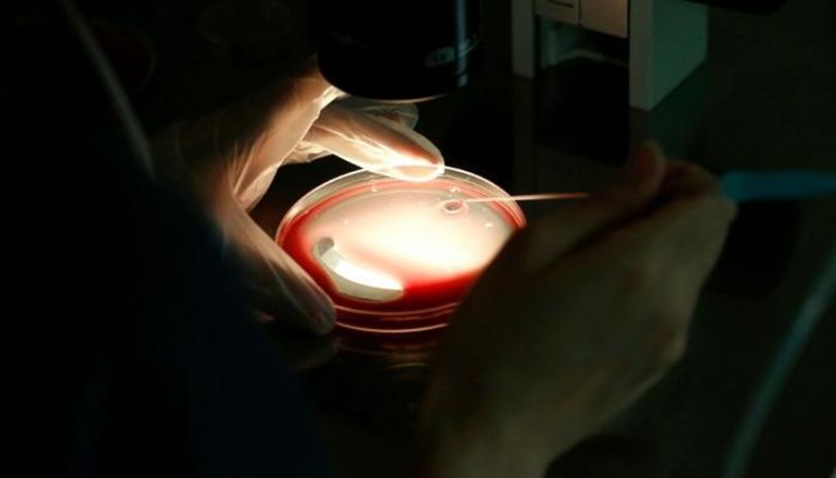 نقل خلايا جذعية مستحثة إلى دماغ مريض بالشلل الرعاش في اليابان