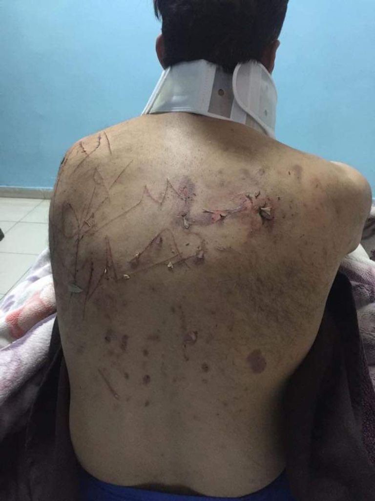 يونس قنديل بعد الاعتداء عليه