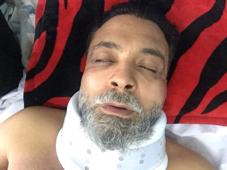 يونس قنديل بعد الاعتداء عليه