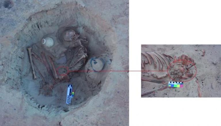 اكتشاف دفنة لامرأة حامل في شهورها الأخيرة في كوم أمبو بأسوان