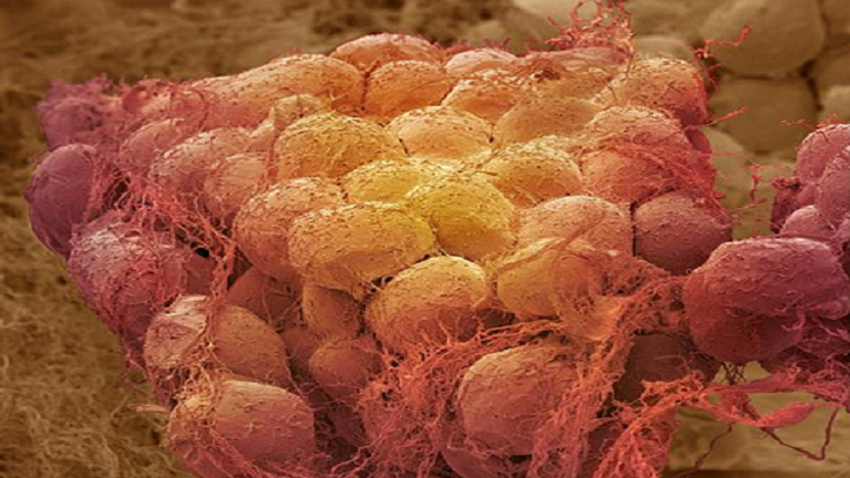 حفرية أقدم حيوان