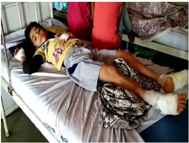 إصابة 4 أفراد من عائلة هندية بحروق إثر انفجار هاتف أثناء الشحن